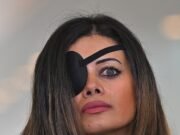 Actualización importante después de que el candidato de los Verdes tuvo que someterse a una cirugía en su ojo después de ser herido durante un rally pro-palestina