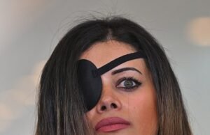 Actualización importante después de que el candidato de los Verdes tuvo que someterse a una cirugía en su ojo después de ser herido durante un rally pro-palestina