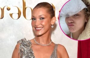 Bella Hadid explica la “Mia” en medio de la batalla de la enfermedad de Lyme