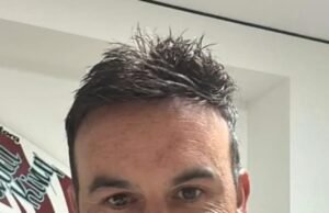 Landon Donovan revela un nuevo aspecto dramático unos días después de suplicar a los fanáticos que obtengan ayuda en las fallas de trasplante de cabello