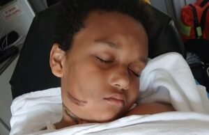 Un niño de 9 años casi muere después de que el cargador de su tableta prendió fuego a su COLLAR