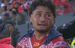 La estrella de Tonga se somete a una cirugía para aliviar la presión sobre el cerebro, su tío proporciona información actualizada sobre su salud y pide un cambio