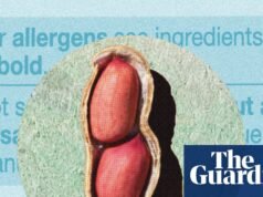 Las alergias al maní han disminuido entre los niños desde 2017: ¿qué pasó? | Bueno, en realidad