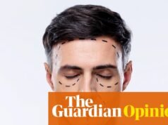 Los jóvenes “Looksmaxxing” esculpen sus rostros. Ser feo es mucho más fácil | David Schilling