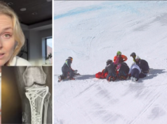 Lindsey Vonn dice que la cirugía la salvó de la amputación de la pierna izquierda