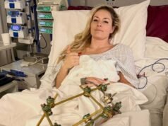 Lindsey Vonn: actualización de la lesión, foto y comentarios sobre la cirugía ‘exitosa’