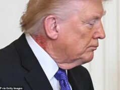 Trump genera nuevos temores de salud cuando los espectadores notan un problema “desagradable” en su CUELLO