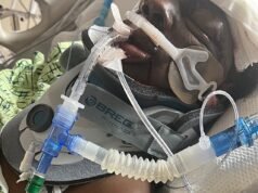 Madre de dos hijos, de 39 años, sufre decapitación interna por un conductor que se da a la fuga después de resbalar y caer en la carretera mientras usaba Crocs