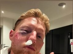 Ben Stokes sufre un revés en el camino para regresar de una terrible lesión facial mientras el cirujano le da malas noticias antes de la temporada del Campeonato del Condado