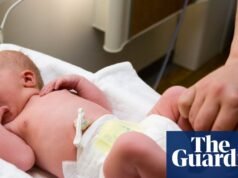 Los servicios de maternidad necesitan inversión en personas y formación, no otra revisión | Servicio Nacional de Salud