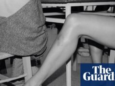 “Los brazos y las piernas son muy expresivos, sobre todo con los moretones”: la absurda fotografía de Yorgos Lanthimos | Fotografía