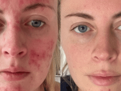 ¿Manchas marrones e imperfecciones? Este suero se enfoca en ambos en un simple paso.