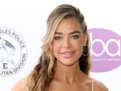 Denise Richards revela fotos de antes y después del estiramiento facial