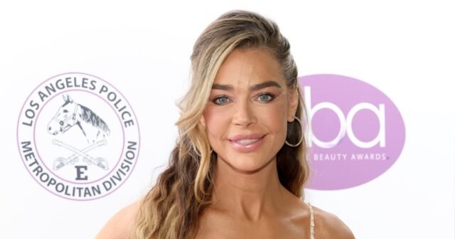GettyImages-2236616681-denise-richards-before-and-after-facelift.jpg