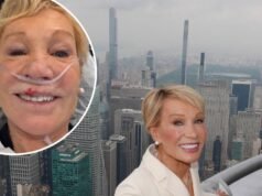 Barbara Corcoran muestra las secuelas de un diente roto y un labio partido