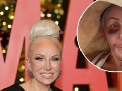 Margaret Josephs de RHONJ habla sobre la recuperación secreta de la cirugía de nariz