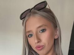 Un técnico de uñas casi muere mutilado y queda con heridas horribles en un ataque de perro no provocado