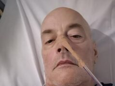 Un australiano trabajador casi MUERE después de un terrible error con el analgésico Nurofen