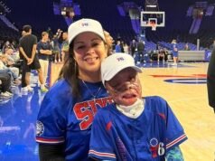 Un niño de 10 años increíblemente valiente visto por primera vez desde que un accidente de avión médico le quemó el 90% de su cuerpo