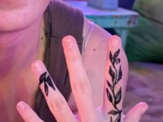 El error de Bali podría dejar a una niña australiana con una cicatriz permanente, mientras su madre emite una severa advertencia: “Se está recuperando lentamente”