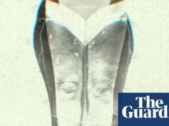 Piernas hinchadas, dolores intensos, piel arrugada: ¿qué es el lipedema? | Bueno, en realidad