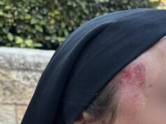 El ataque a una monja en Jerusalén genera una condena generalizada