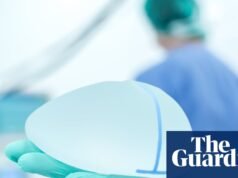 Las reducciones de senos en el Reino Unido superan las ampliaciones por primera vez, según muestran los datos | Cirugía plástica