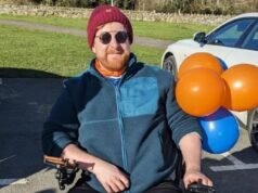 ¿Qué es la ENM? Explicando la enfermedad del actor de Juego de Tronos