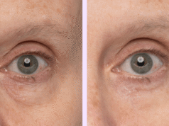 ¿Debajo de las bolsas debajo de los ojos? Este gel para ojos de $30 elimina visiblemente la hinchazón en 5 minutos