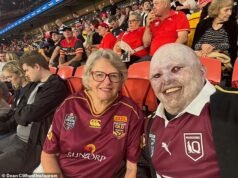 Un hombre australiano con una afección cutánea preocupante va al fútbol con su madre, y lo que pasó después le hará hervir la sangre.