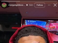 Nottingham Forest está considerando colocarle una MÁSCARA a Morgan Gibbs-White después de la horrorosa colisión de la estrella con la estrella del Chelsea, Robert Sánchez, en la victoria por 3-1.