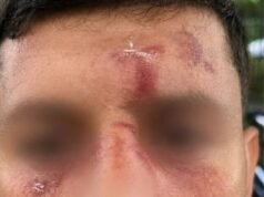 Un judío atacado por una banda de hombres enmascarados “después de hablar hebreo en su teléfono móvil” frente a su casa en Golders Green