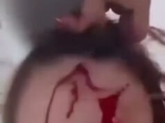 Miss Venezuela Global publica imágenes impactantes de ella cubierta de sangre en una habitación de hotel saqueada ‘después de ser atacada por un estilista famoso’