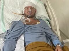 Jaxen estaba en sus primeras vacaciones en solitario cuando un pescador lo encontró inconsciente en una carretera remota. Ahora está aprendiendo a caminar nuevamente después de una grave lesión cerebral.