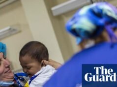 Comprender los desafíos de vivir con labio hendido | Discapacidad